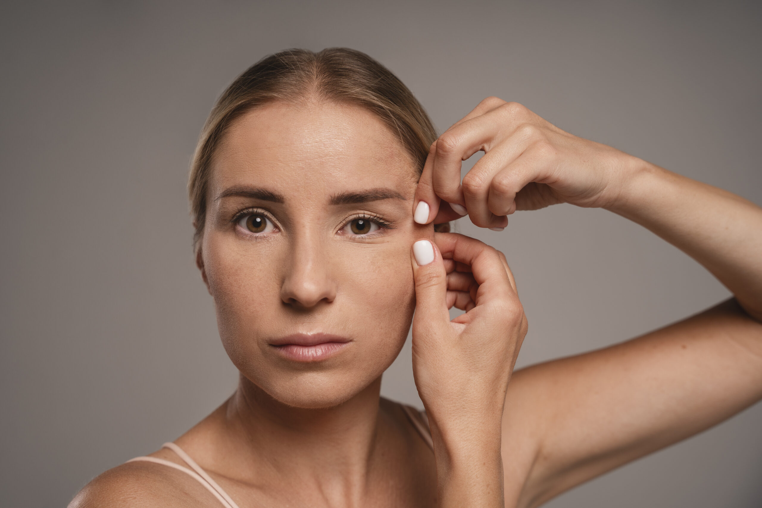 How to Get Rid of Under-Eye Wrinkles When Smiling