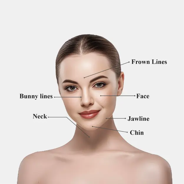 skin tightening treatable areas