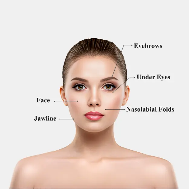 Thread Lift Treated Areas