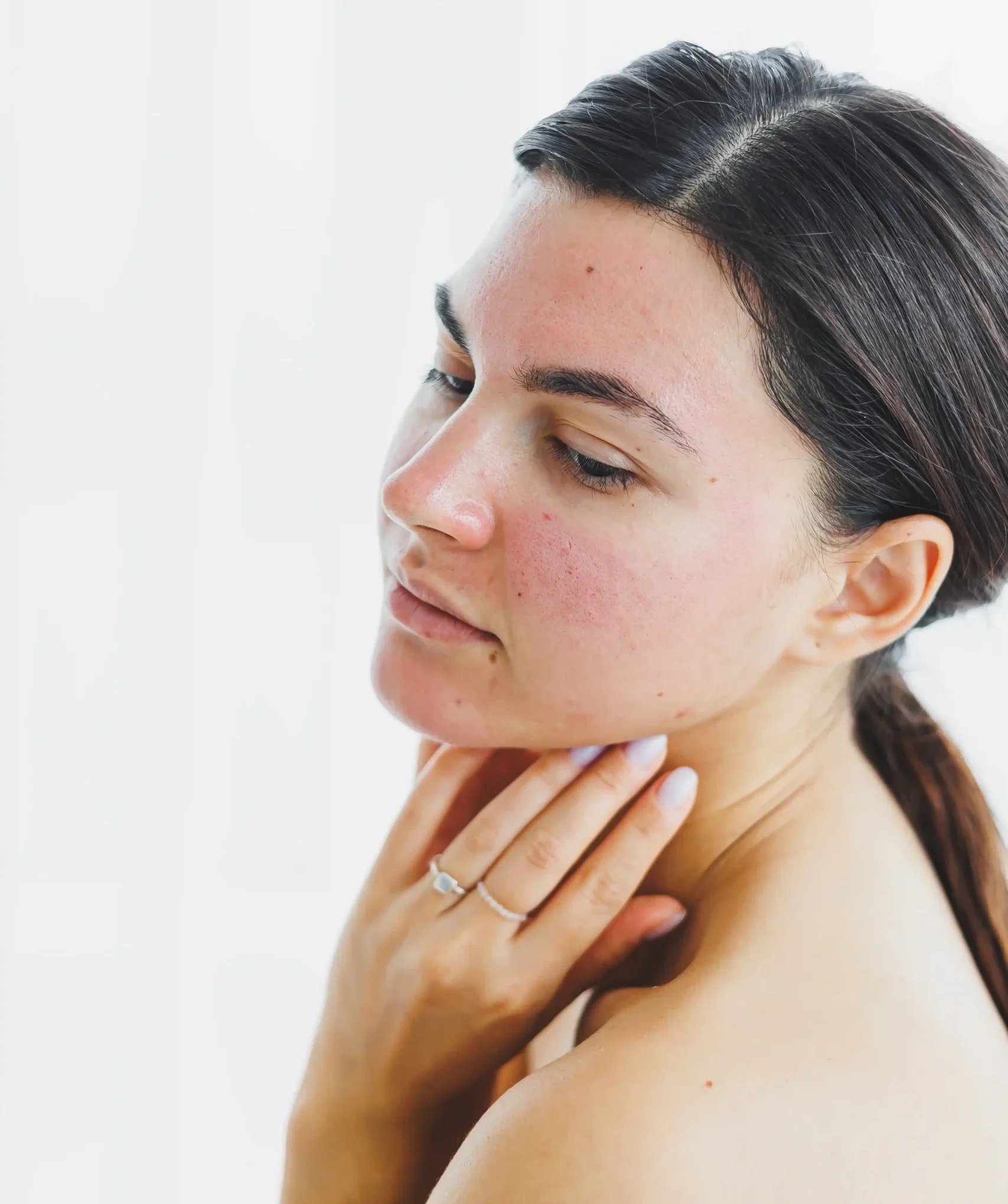 closeup-womans-face-with-redness-mask-face-your-client-beauty-salon-problematic-skin-facial-skin-care
