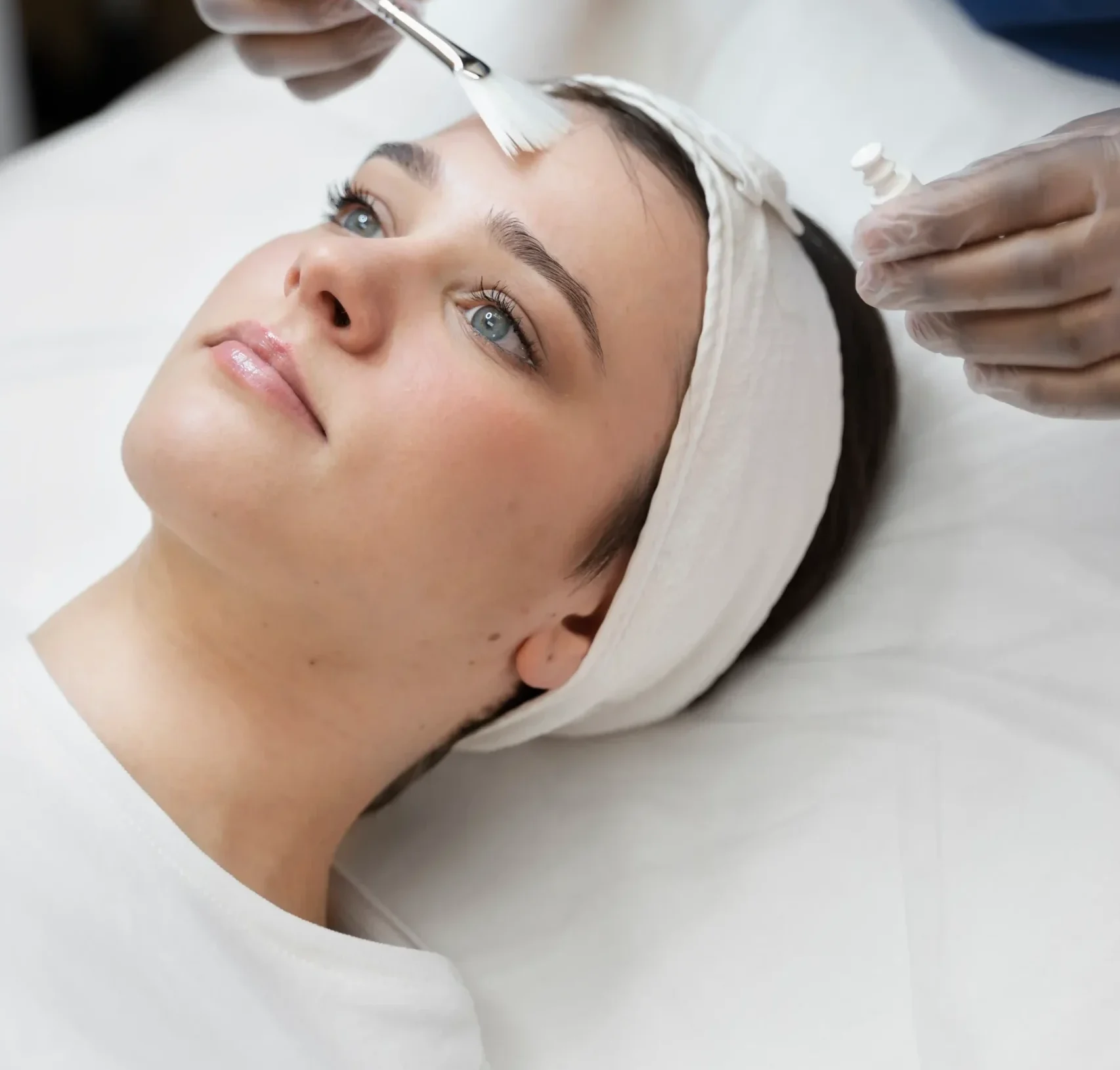 Chemical peel treatment in queens
