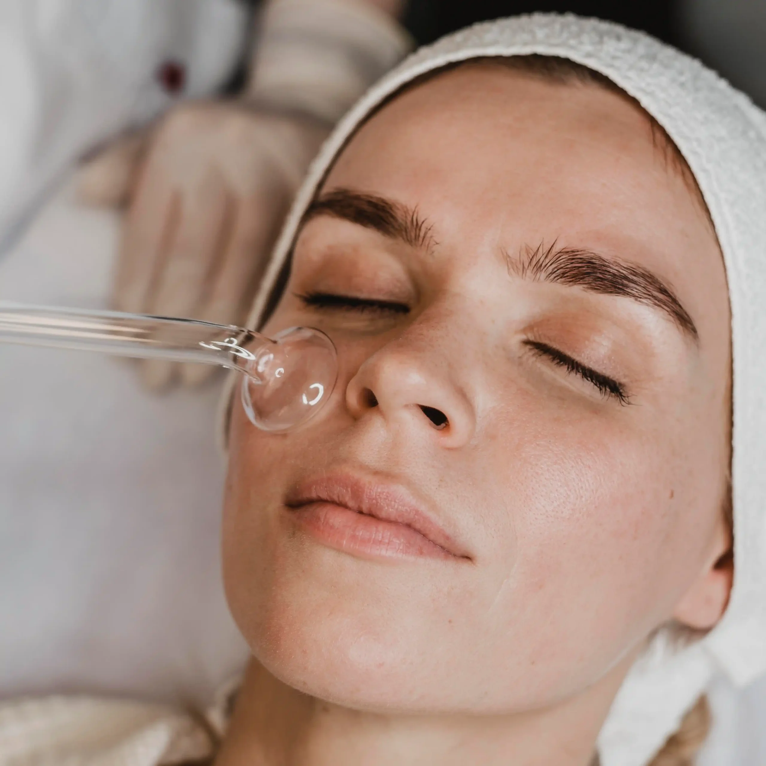 Chemical peel treatment