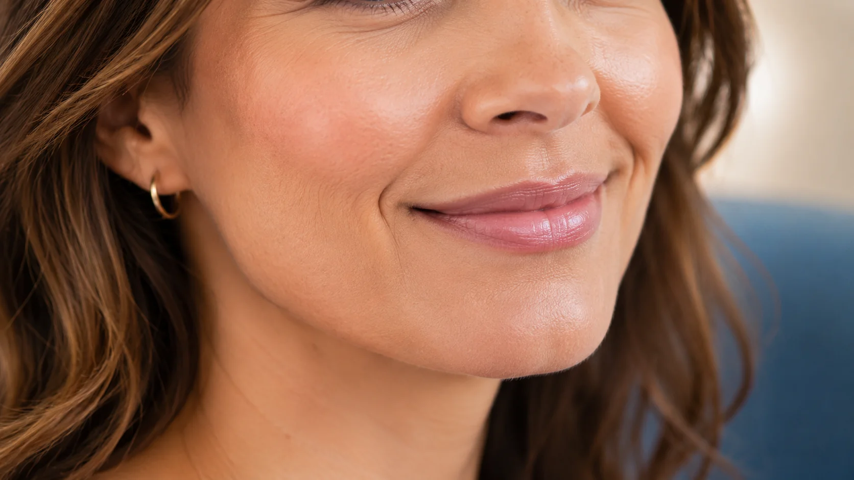Smooth lower-face skin after marionette line filler treatment at Adult and Pediatric Dermatology in Forest Hills